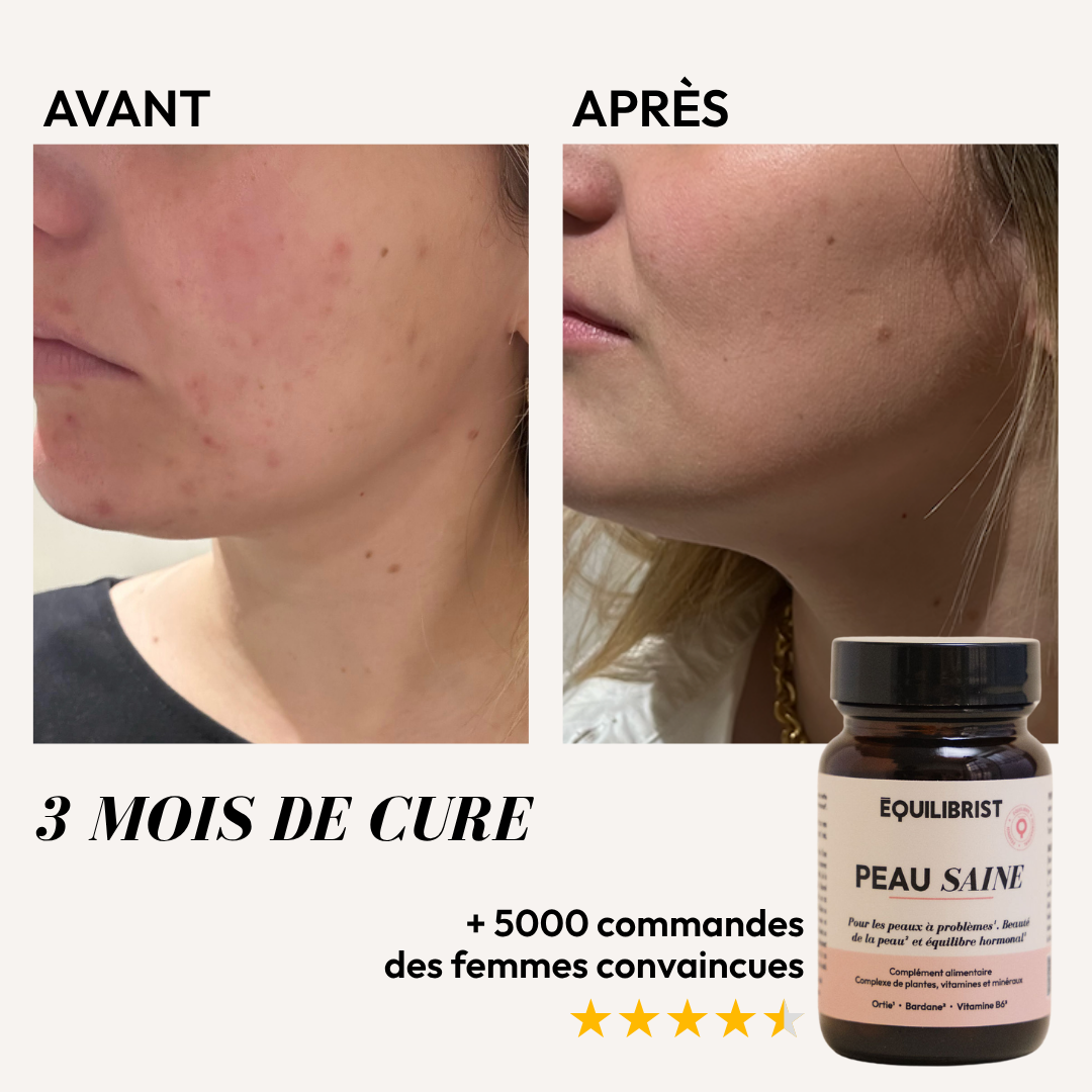 PEAU SAINE (Opéka)